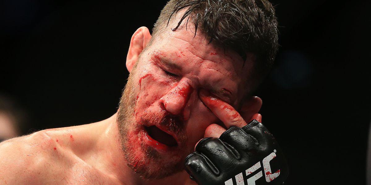 Michael Bisping's UFC career success despite eye injury, overcoming obstacles to become champion, inspiring story of determination and perseverance in MMA.